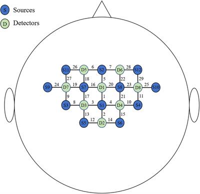 Task-State Cortical Motor Network Characteristics by Functional Near-Infrared Spectroscopy in Subacute Stroke Show Hemispheric Dominance